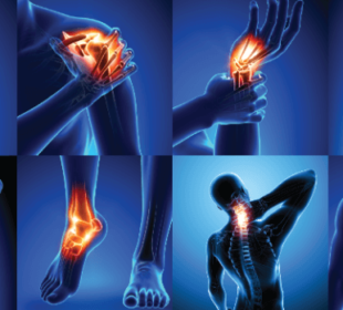 medication for joint pain
