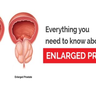 Prostate Enlargement